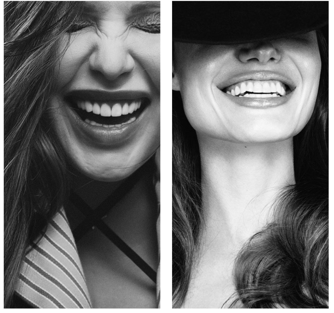 Hollywood Smile au Maroc