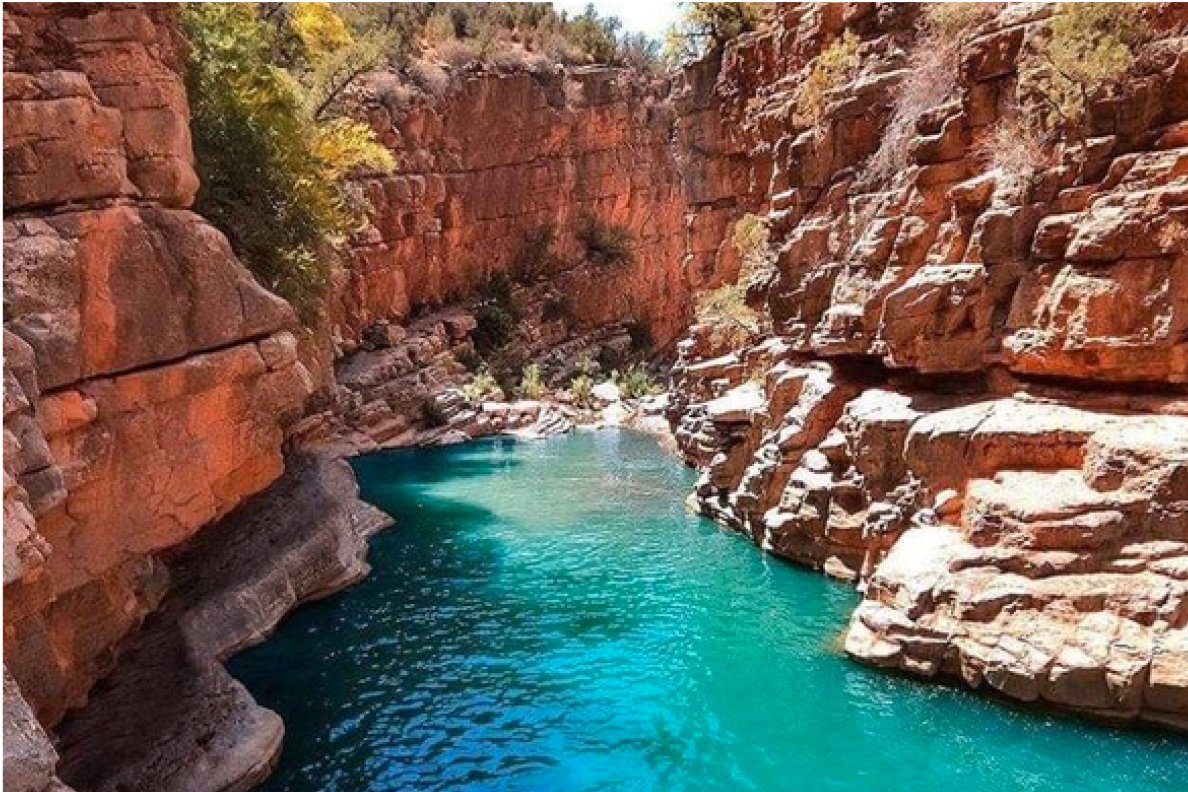 Hollywood Smile au Maroc