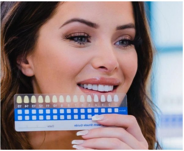 Hollywood Smile au Maroc